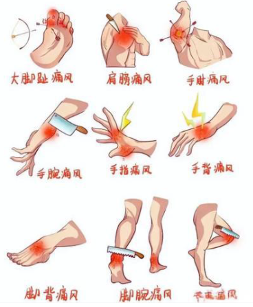 别再硬扛关节痛！中医···